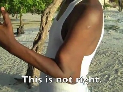 Il a le bras cassé depuis 2 ans