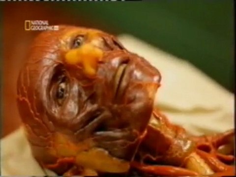 Andreas Vesalius (1543): Anatomia humana