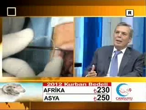 implantta Yapay Çene Kemiği Tekniği Nedir?