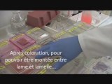 Techniques conventionnelles en anatomopathologie
