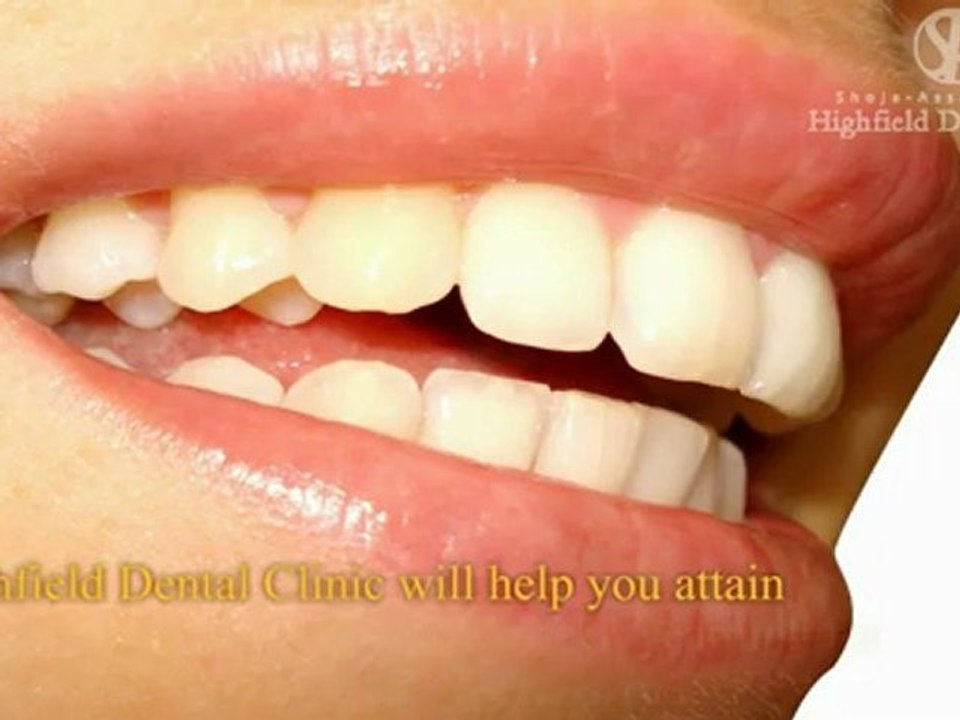 Highfield Dental Clinic - Birmingham dentists, Dental Surgery Birmingham,Tooth Whitening 4| Call us on 0121 455 6974