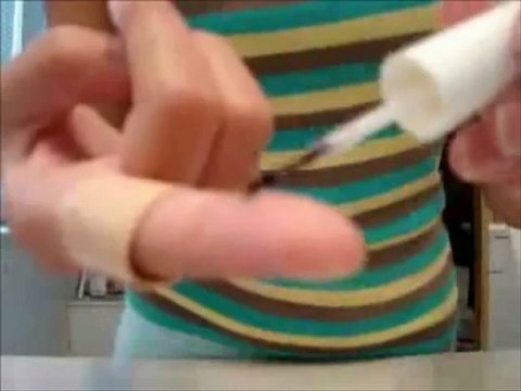 Remedio casero para eliminar las verrugas