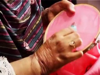 Depilex Smileagain - Helping acid burn victims