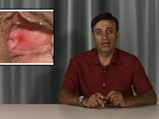 Vulvodini ve vulvar vestibulit sendromu nasıl tedavi edilir?