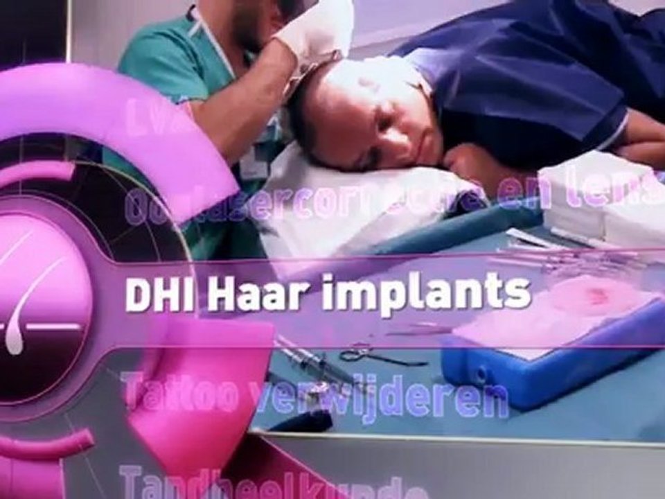 Voor haartransplantatie DHI behandeling is een goede oplossing