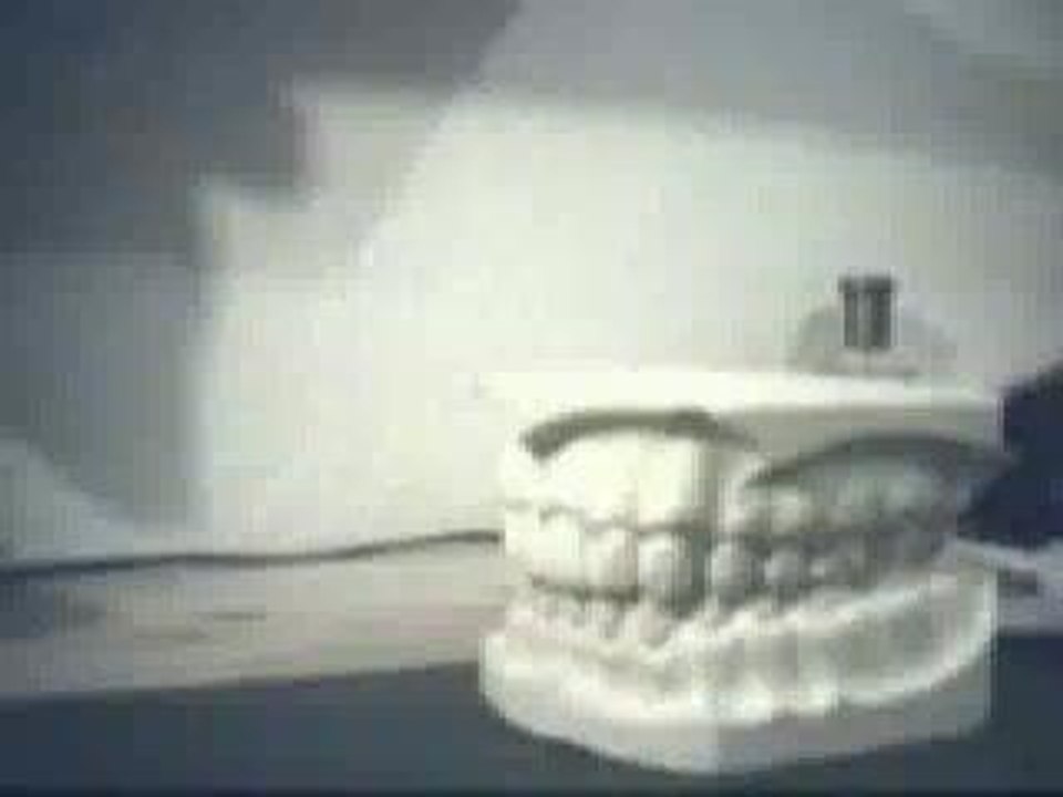 Des dents, 'tition !