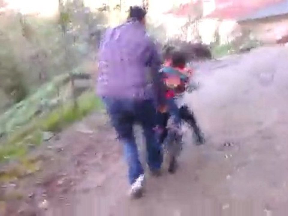 Bisiklet kazası
