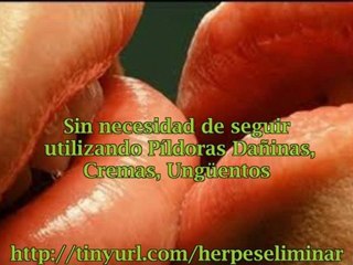 Tratamiento para el herpes bucal
