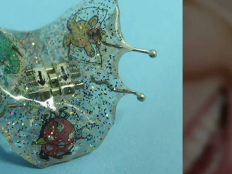 Unsichtbare Zahnspangen Ludwigshafen Am Rhein Ursula Hoecker-Groß Zahnärztin für Kieferorthopädie