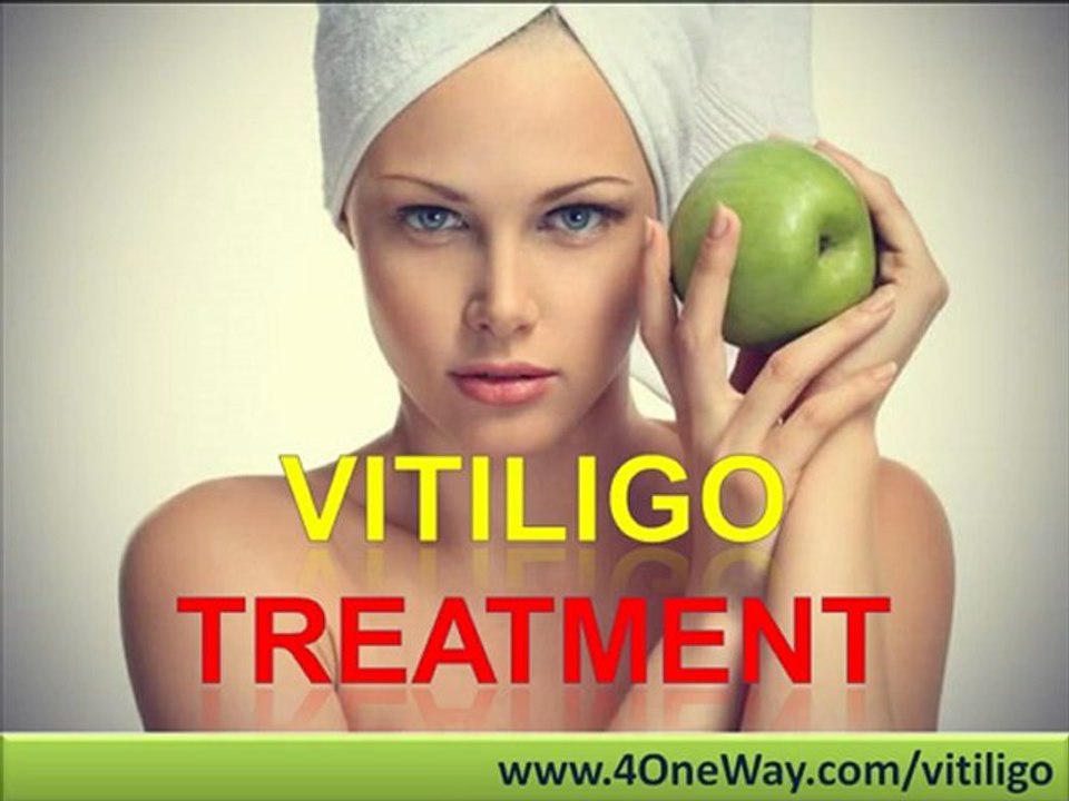 Vitiligo Treatment