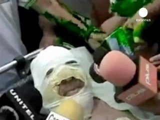 Bolivie : une station radio attaquée en direct