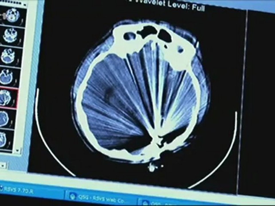 Quand est-on vraiment mort ?