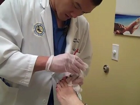 Chronic Ingrown Toenail Surgery - Naples Podiatrist / Family Foot and Leg Center