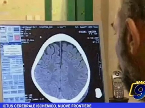 Pensa alla Salute | Ictus Cerebrale Ischemico, nuove frontiere