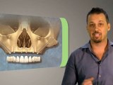 Alternative Dental Implants Procedures - CAID Australia