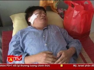 ANTÐ - Phó Giám đốc CATP Hà Nội thăm hỏi CBCS bị tấn công khi làm nhiệm vụ