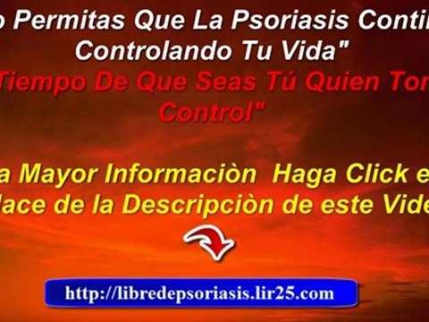 remedios caseros para la psoriasis - como curar la psoriasis