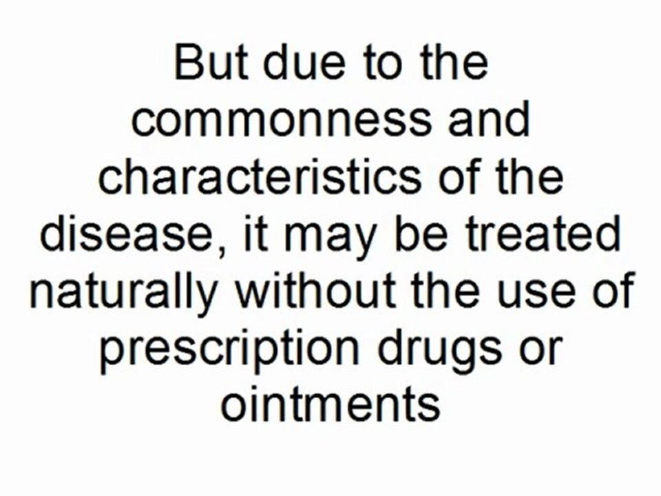 New Treatments For Ringworm