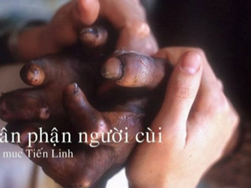THÂN PHẬN NGƯỜI CÙI