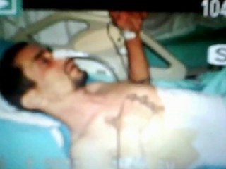 BİDİ BABANIN acılı 4GÜNÜ kırık protikson gururla ve üzüntüyle sunar