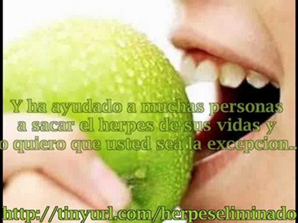 Remedios caseros para el herpes zoster