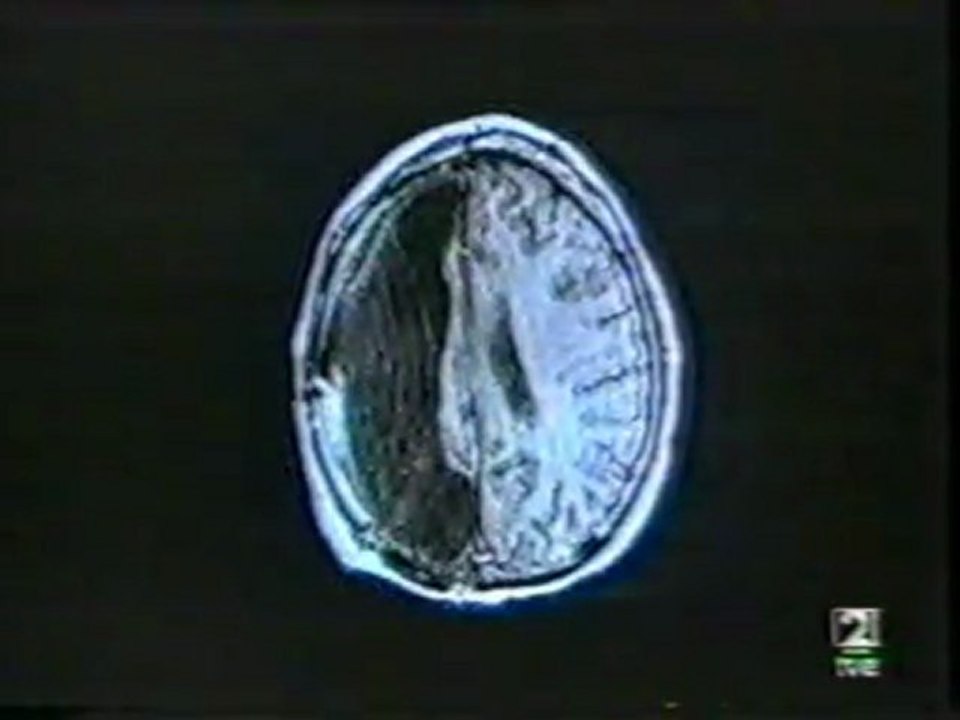 Plasticidad cerebral: Jonathan Wilbanks