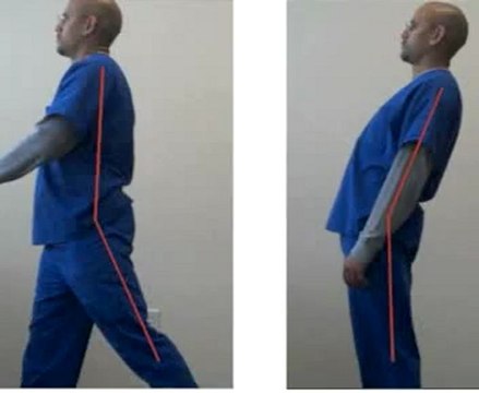 Quiropractico Atlanta / Gainesville GA - Ejercicio Para Disco Herniado - Quiropractico Gainesville GA