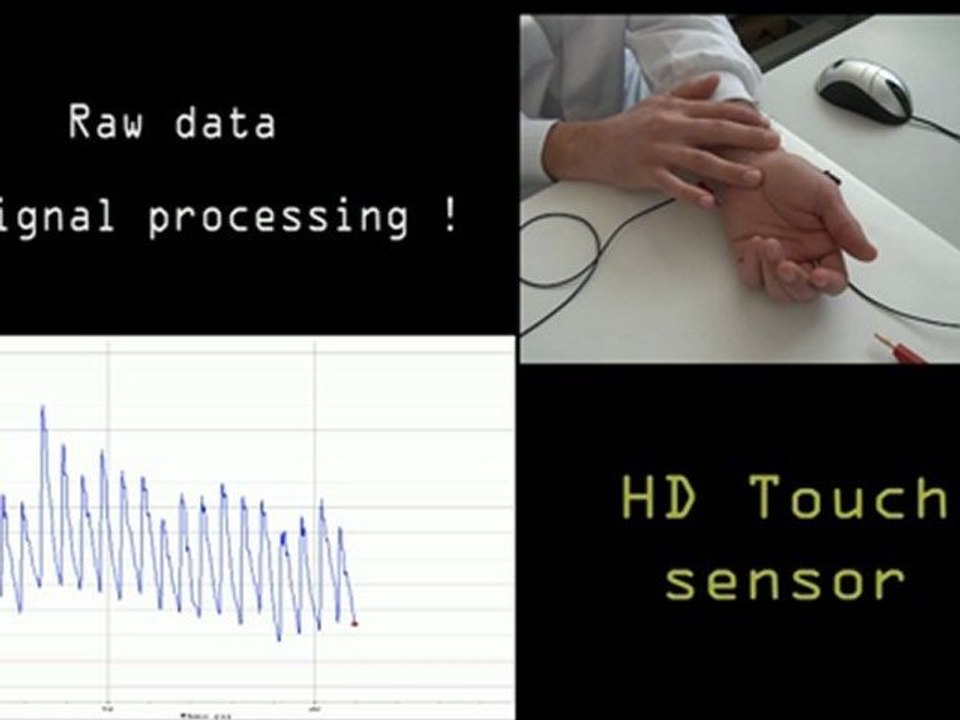 Monitoring heart beat with ultra-sensitive nano sensor