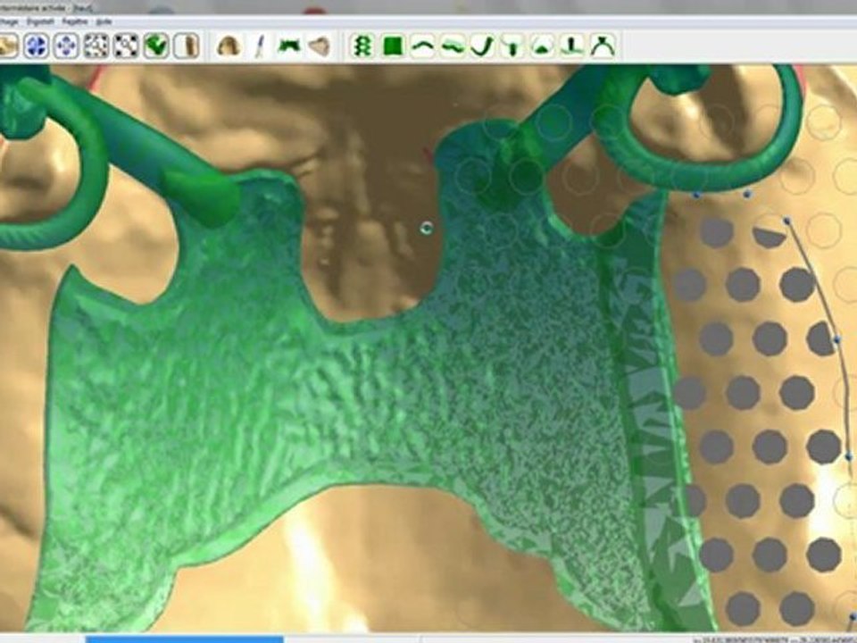 Logiciel DIGISTELL pour la création de châssis/squeletté pour les prothésistes dentaires (Partie 2 : Modélisation de la maquette du châssis/stellite)