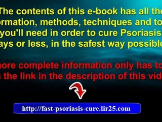 psoriasis natural remedy - psoriasis remedy - natural remedy for psoriasis