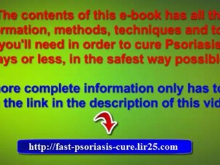natural psoriasis treatment -  psoriasis home treatment - treat psoriasis