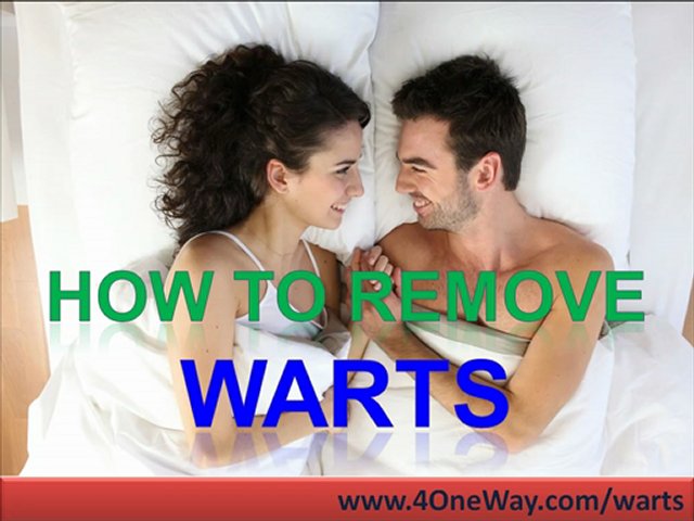 Genital Warts Treatment