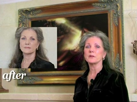 Facelift Before & After - San Diego (619) 271-6703