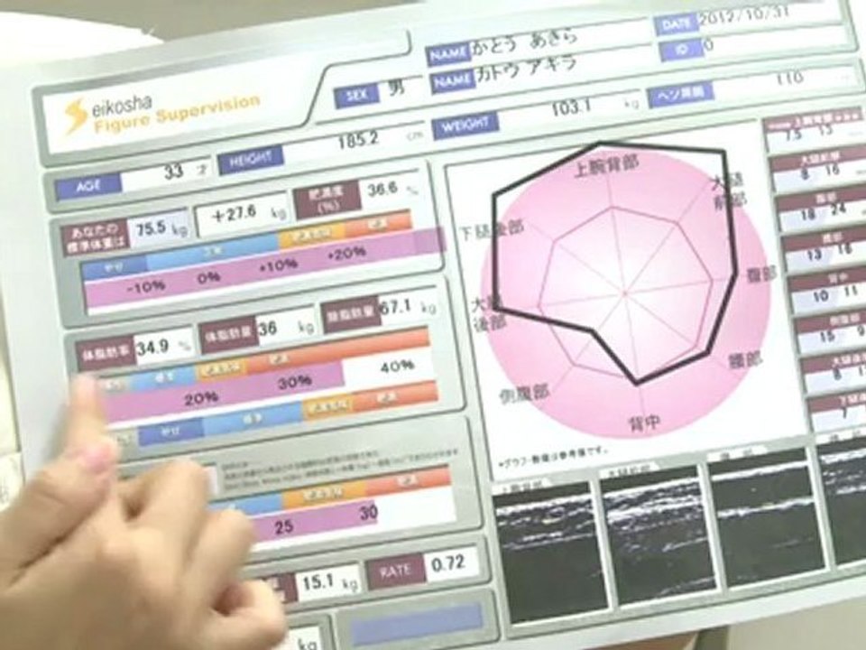 Japon: au pays des sumos, l'obésité est théoriquement illégale