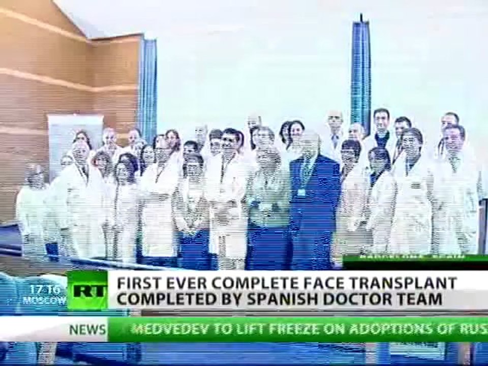 World's first ever full face transplant completed by Spanish doctors
