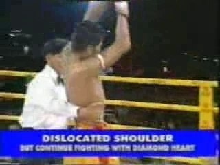 Sakmongkol vs Perry Ubeda