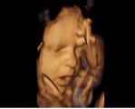 Amazing picture shows baby yawning in the womb