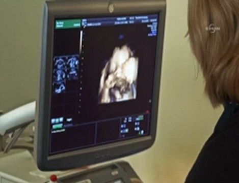 Anne karnındaki bebeğin esnemesi görüntülendi -TIMETURK.COM