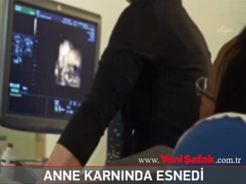 Anne karnındaki bebeğin esnemesi görüntülendi