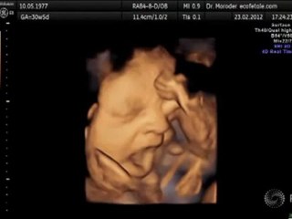Baby Yawns in Womb  - 4D Ultrasound Video Footage