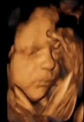 En video: Estudio revela que los bebes bostezan dentro del útero