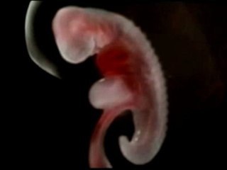 Teaser Clip "CETTE PHOTO DE TOI"