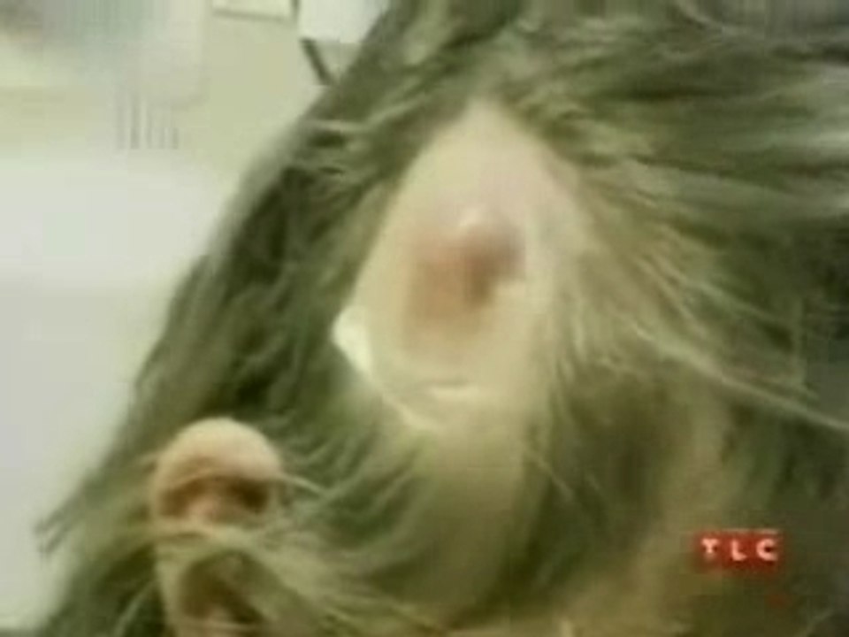 le ver dans la tete ?!?!?