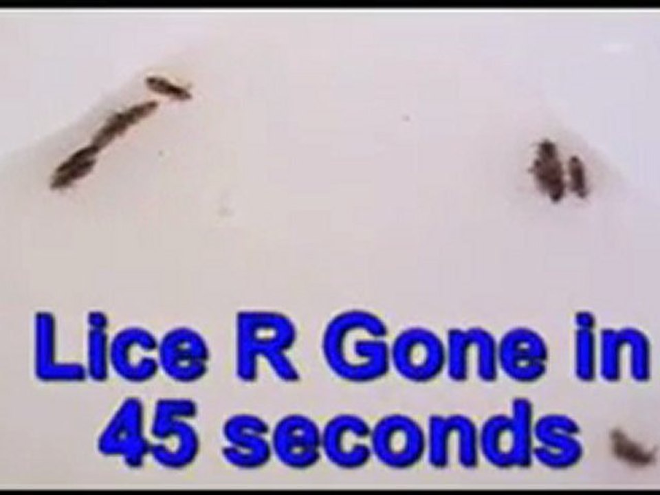 Eliminate Head Lice Fast | (800) 294-6816 | Watch Head Lice Die in 60 Seconds