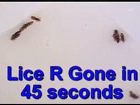 Eliminate Head Lice Fast | (800) 294-6816 | Watch Head Lice Die in 60 Seconds