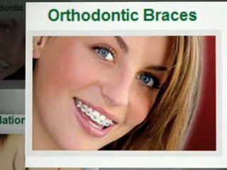 Mint Dental Alaska Services