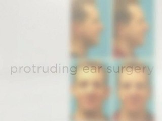 rhinoplasty portland oregon