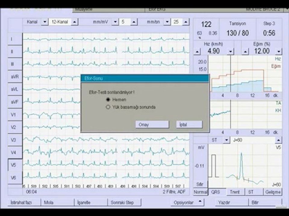 Alman devi Custo-med marka Cardio Consept Ürünlerimizden Efor EKG ( Vakumlu sist.)   ERÇA GRUP Medikal ve Güvenlik Sistemleri    Erkan ÇAKIR / General Manager    Gsm:+90 544 267 38 66  e-mail :info@ercagrup.com