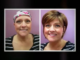 False Eyebrows For Cancer Patients