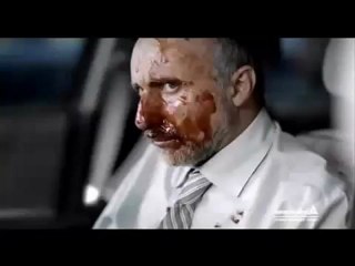 En Çok Güldüren Ve Eğlendiren  Komik Kazalar